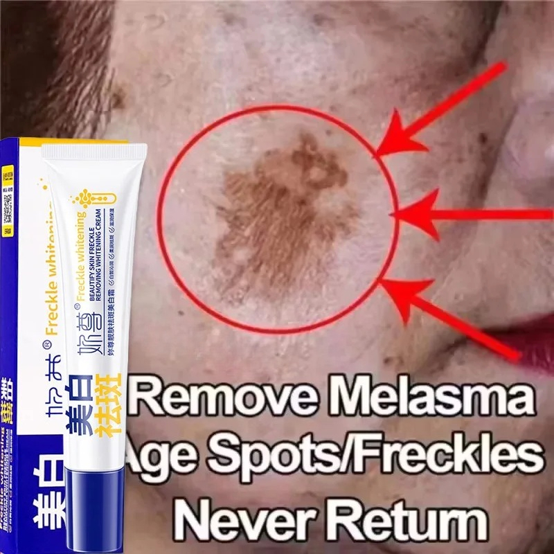 Skincare Korea - Krim Pemutih Penghilang Noda Ampuh Mencerahkan