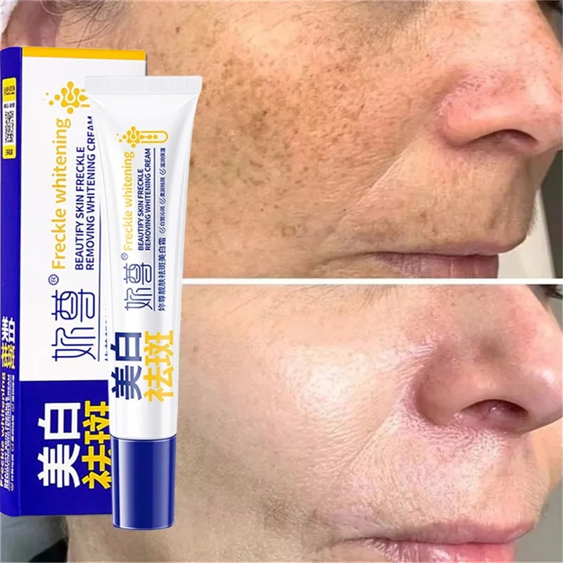 Krim Pemutih Penghilang Noda A - Skincare Korea ulasan dan harga