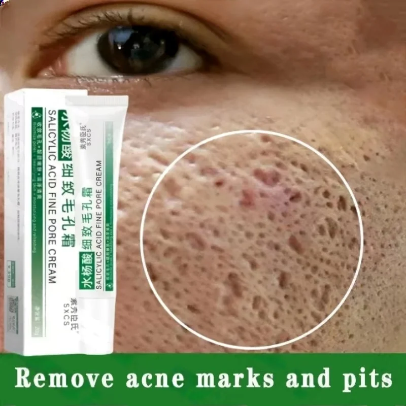 Krim Pembersih Pori Asam Salis - Skincare Korea ulasan dan harga
