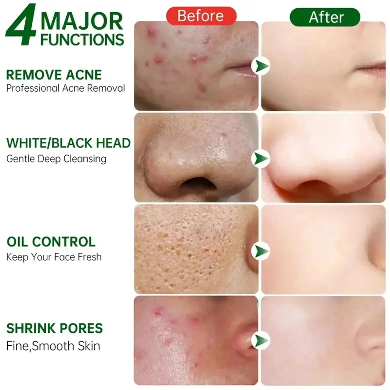 Krim Pembersih Pori Asam Salis - Skincare Korea ulasan dan harga