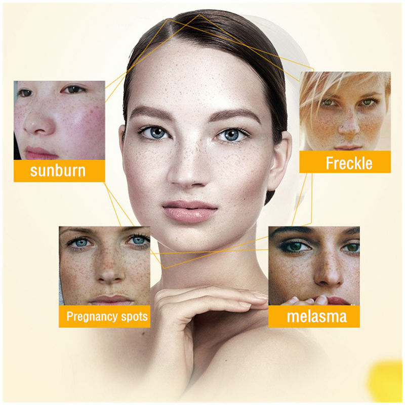 Dimollaure Krim Pemutih Bintik - Skincare Korea ulasan dan harga