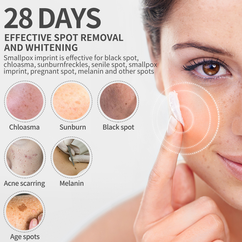 Dimollaure Krim Pemutih Bintik - Skincare Korea ulasan dan harga