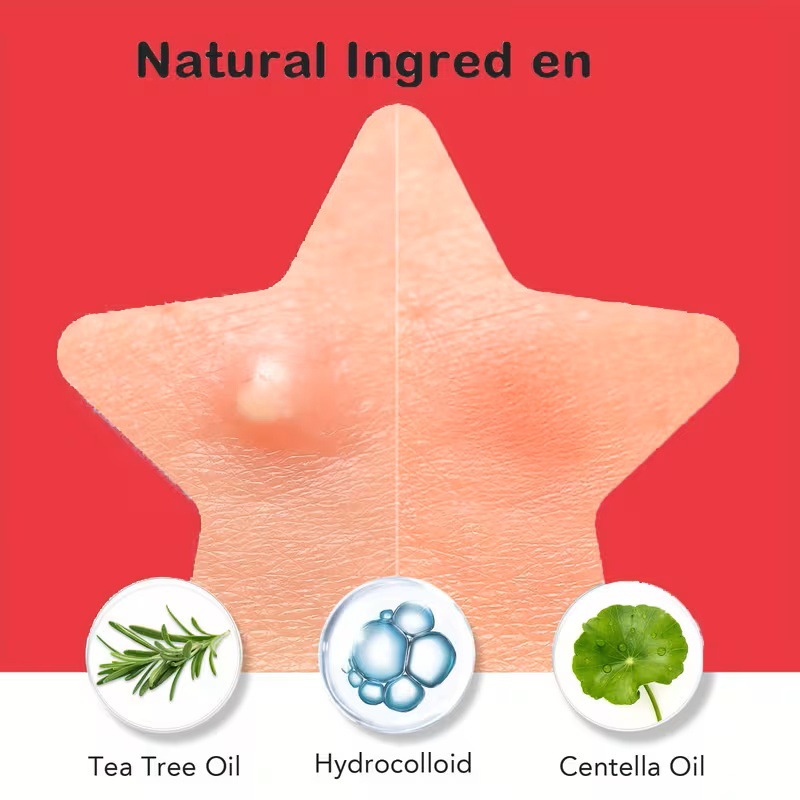 200/400 Buah Tambalan Jerawat  - Skincare Oil Control ulasan dan harga