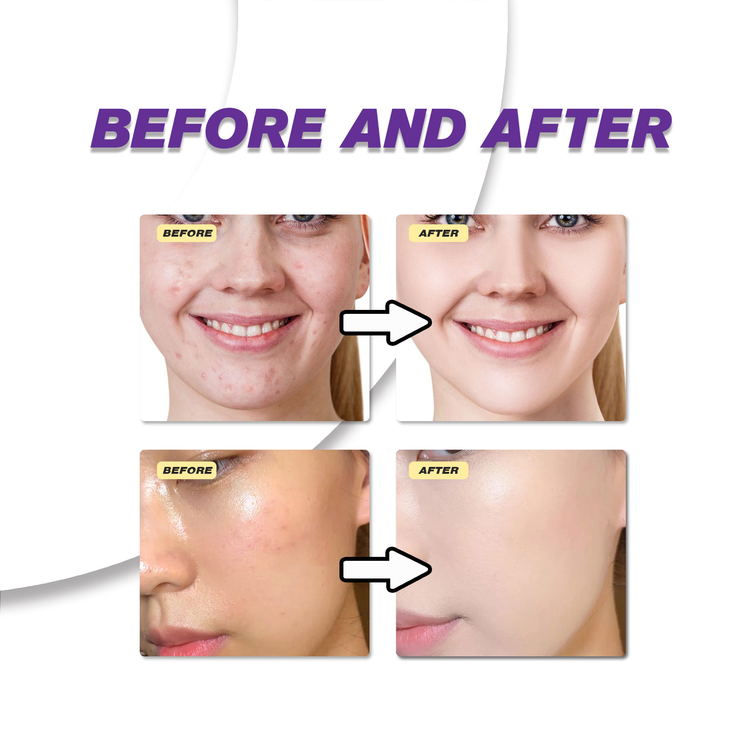 Krim Asam Azelaat Ringan Menin - Skincare Skintific ulasan dan harga