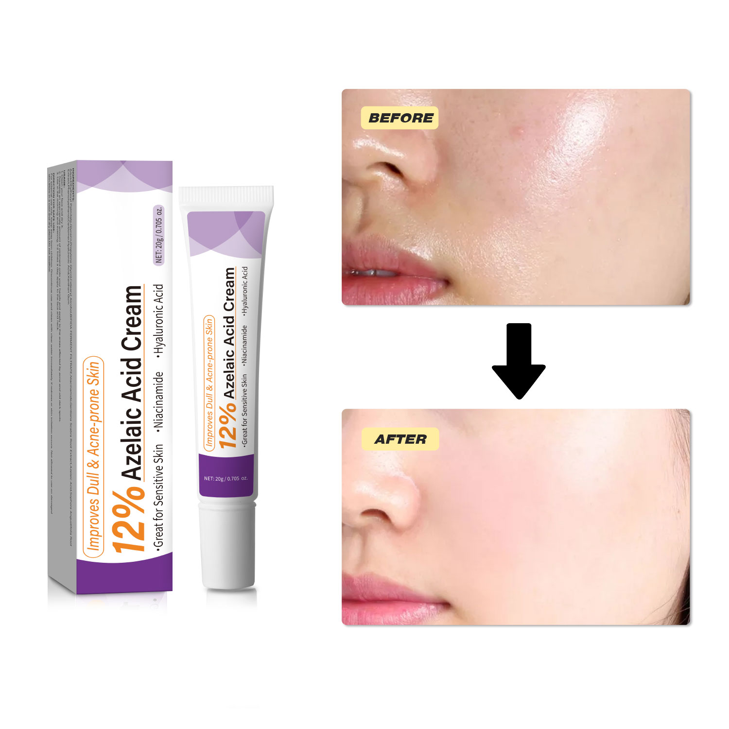 Krim Asam Azelaat Ringan Menin - Skincare Skintific ulasan dan harga